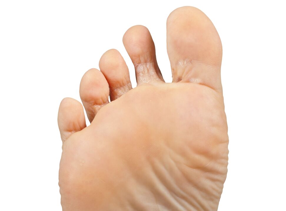Funger-good-trial-cream-zxcvbnmqwert