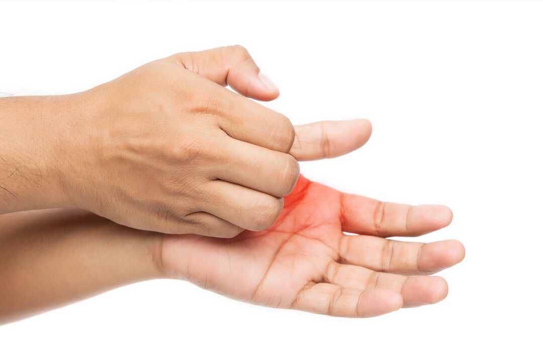Itching with a mushroom and treatment with Demyxil cream