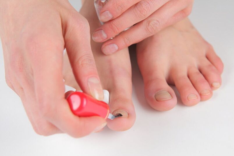 Foot fungal prevention